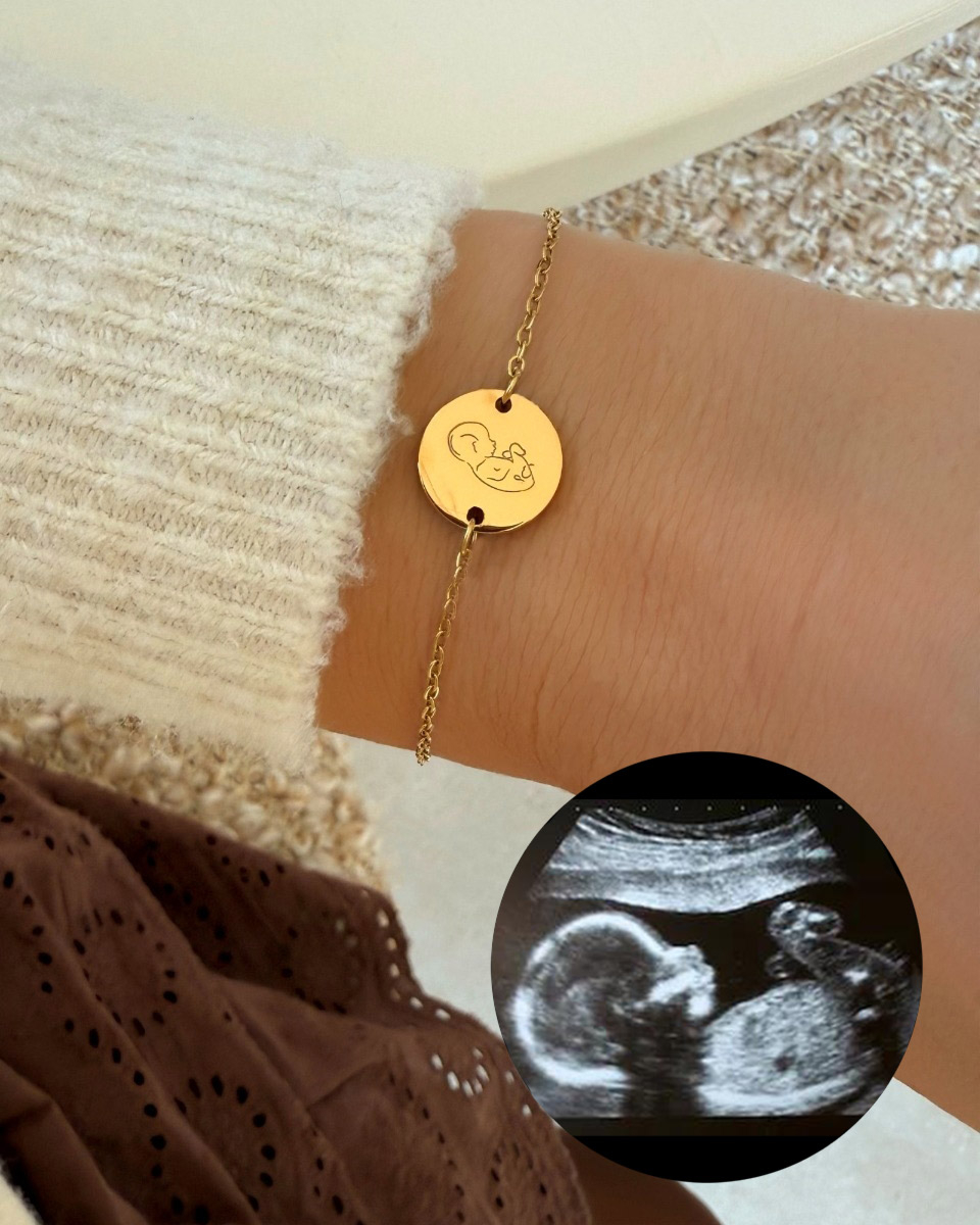 Gouden echo armband voorbeeld
